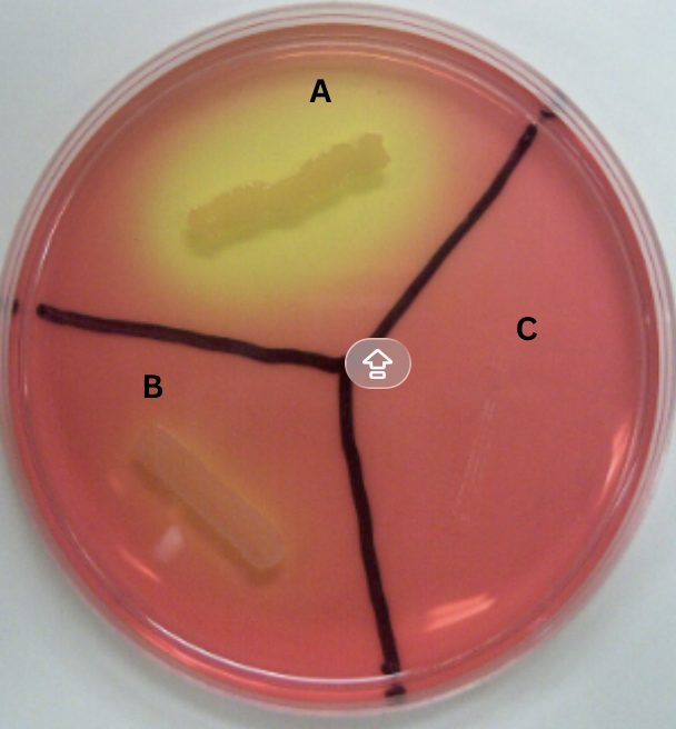 <p>This is a <strong>Mannitol Salt Agar</strong>, What does A, B, and C interpret?</p>