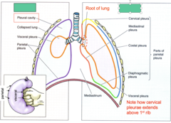 <p>What is the difference between the two lungs in this image?</p>
