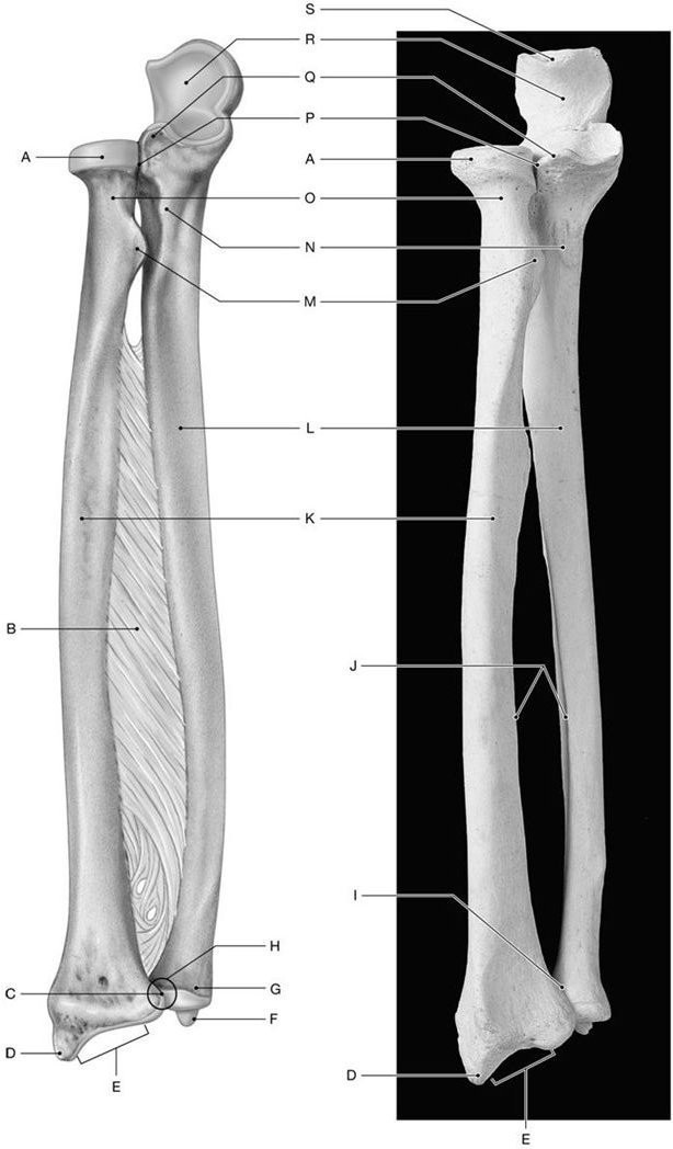 <p><span>Identify the structure indicated by Label B.</span></p>