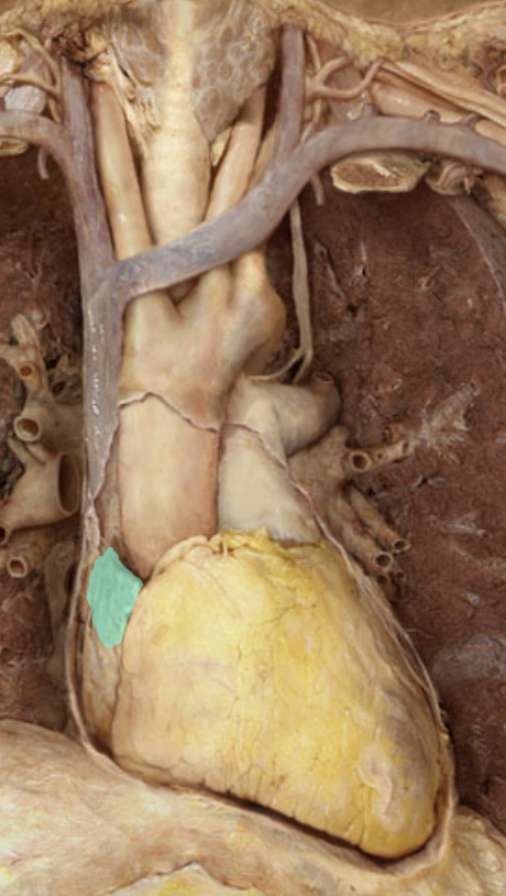 <p>Identify the feature of the right atrium</p>