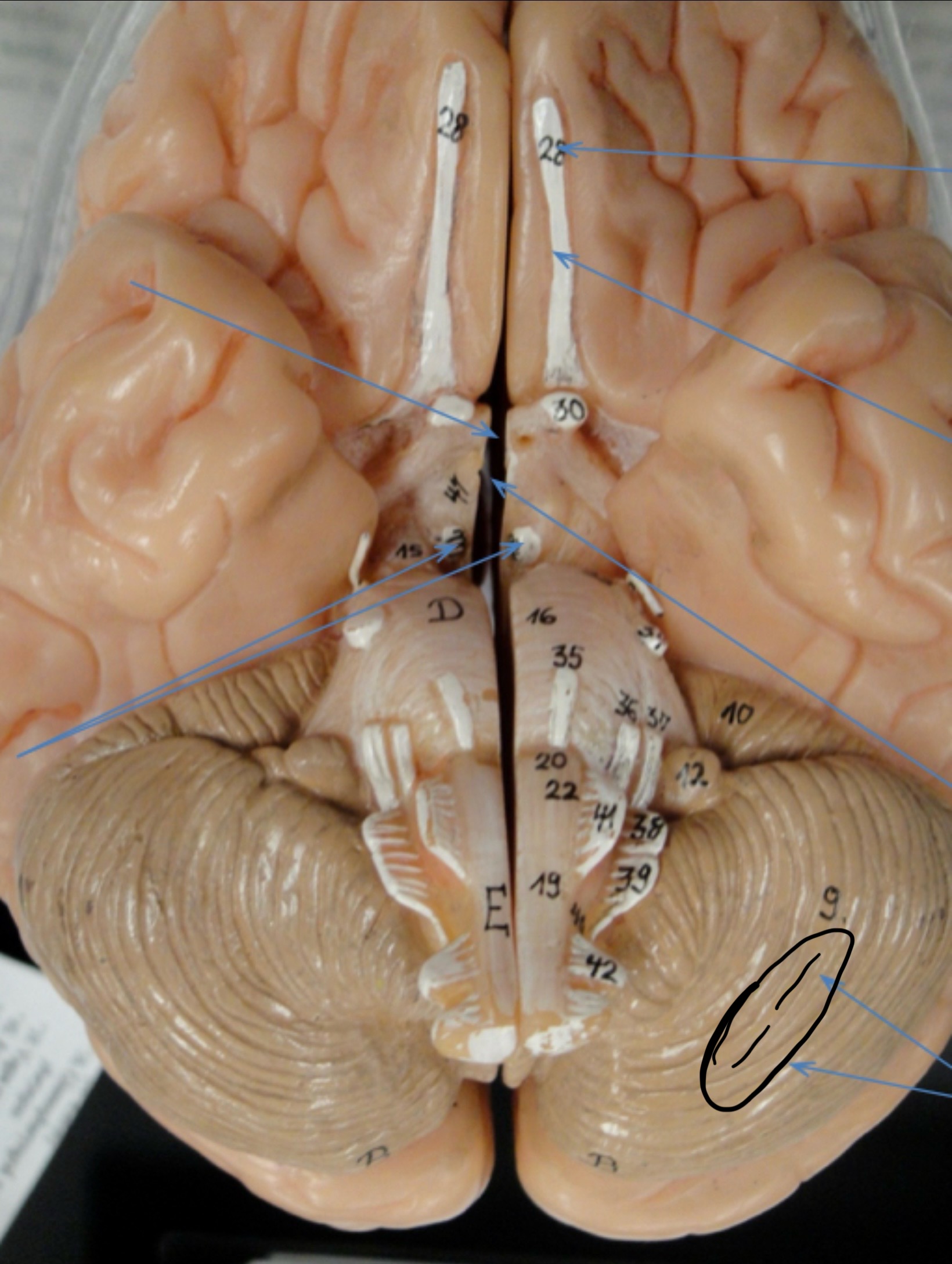 <p>Identify the circled area?</p>