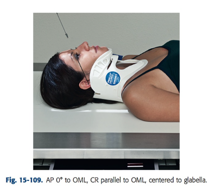<ul><li><p>Angle CR parallel to OML: With a patient in a c-collar, this often occurs approximately 10-15 degrees caudal, but each patient and situation will be different</p></li><li><p>Center CR to glabella; then center IR to projected CR</p></li></ul><p></p>