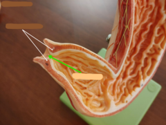 <p>What structure is the green arrow pointing to?</p>