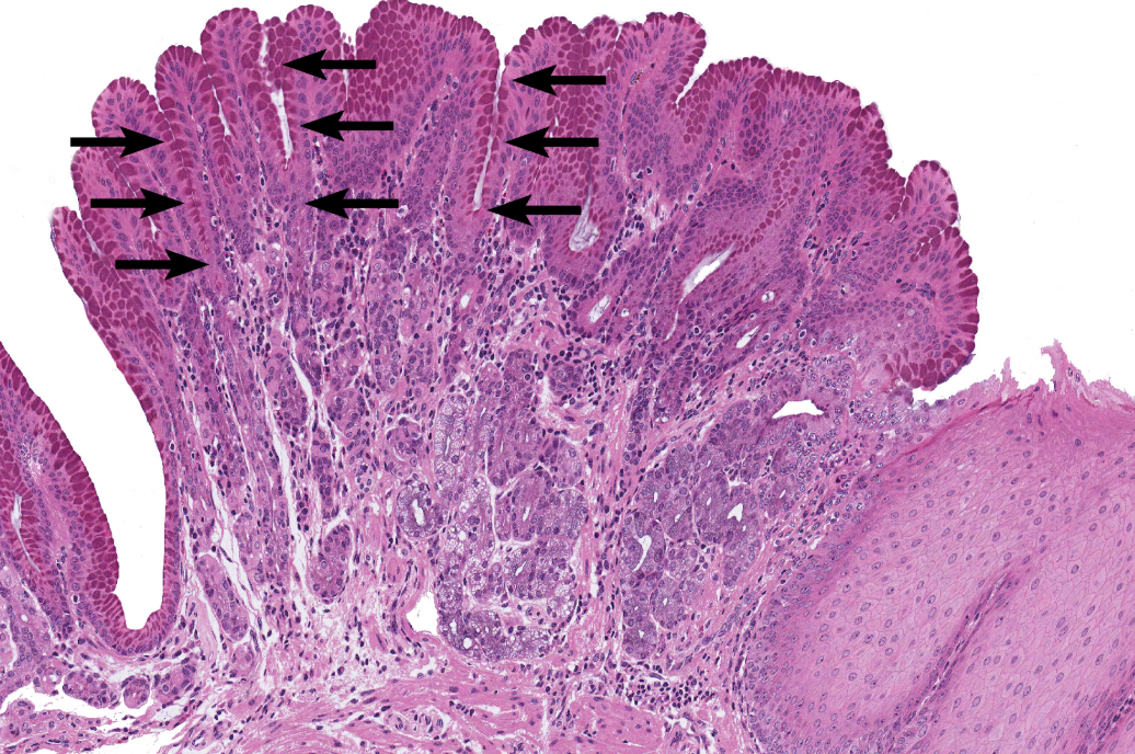 <p>Stomach</p><p><strong>NOTICE: THE DEEP GASTRIC PITS WITH DARK STAINED GASTRIC GLANDS AROUND THEM AND NOT MANY GOBLET CELLS</strong></p>