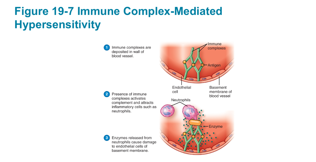 <ul><li><p>Antibodies form against and react with soluble antigens in the serum</p></li><li><p>Form immune complexes that lodge in the basement membranes beneath the cells (usually IgG)</p><ul><li><p>Activate complement, causing inflammation</p></li><li><p>Immune complexes form only when there is a certain ratio of antigen and antibody</p></li></ul></li></ul><p></p>