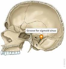<p>shallow groove</p><p>ex: sigmoid sulcus</p>