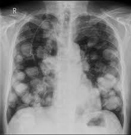 <p>Diagnosis + sign name</p>