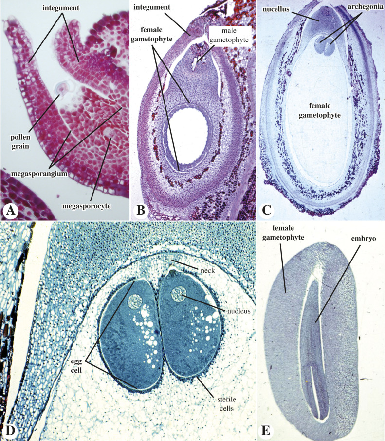 <p>Megasporangium</p>