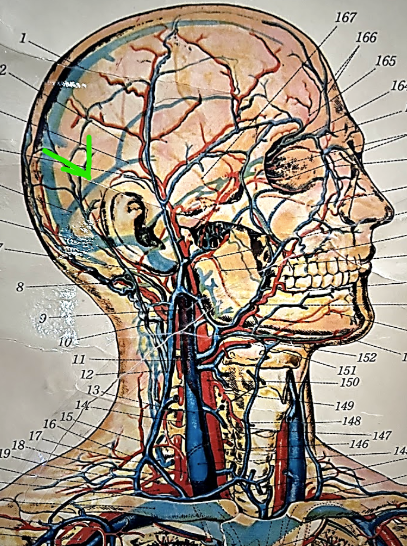 term image