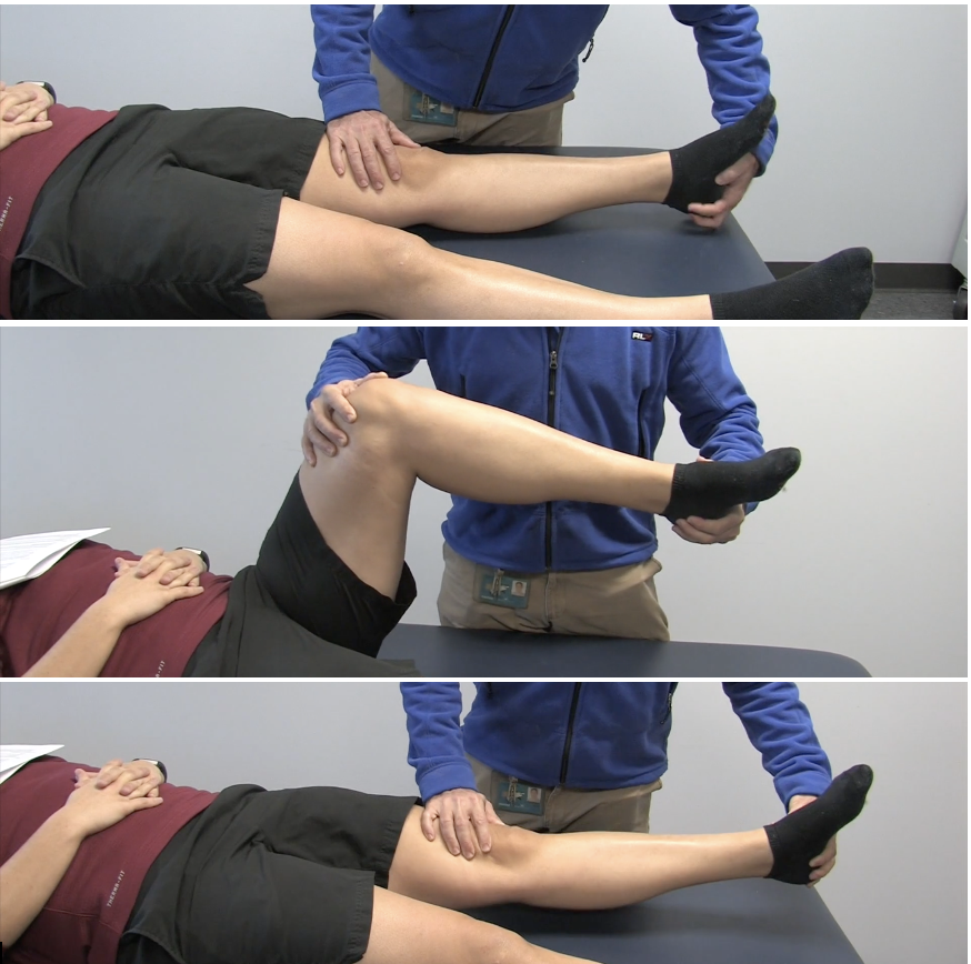 <p>LIGAMENTOUS STABILITY + “Patellofemoral &amp; Other”</p><p><strong>Purpose</strong></p><ul><li><p>Medial patellar plica syndrome</p></li></ul><p></p><p><strong>How to perform</strong></p><ol><li><p>pt supine</p></li><li><p>Glide the patella medially and hold it</p></li><li><p>Passively IR tibia &amp; flex knee</p></li><li><p>Passively extend knee from the flexed position</p></li></ol><p></p><p><strong>Positive test</strong></p><ul><li><p><span style="color: red;"><strong>A palpable clunk under the patella as the knee extends</strong></span><strong> = medial patellar plica syndrome</strong></p></li></ul><p></p>