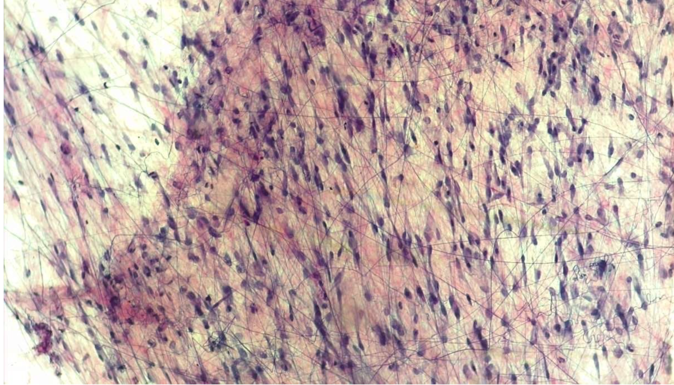 <p>Areolar Connective Tissue </p>