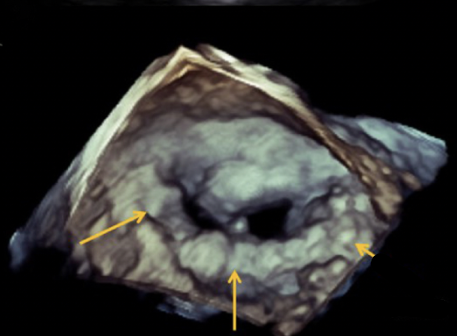 term image