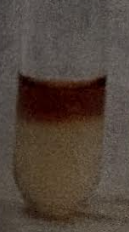 <p>Positive VP result </p>