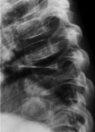<p>What is the diagnosis in this pediatric patient with pain?</p>