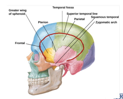 <ul><li><p>Frontal bone (inferior lateral part)</p></li><li><p>Parietal bone (inferior portion)</p></li><li><p>Temporal bone (squamous part)</p></li><li><p>Sphenoid bone </p></li></ul><p></p>