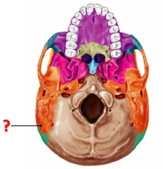 <p>Identify this bone.</p>