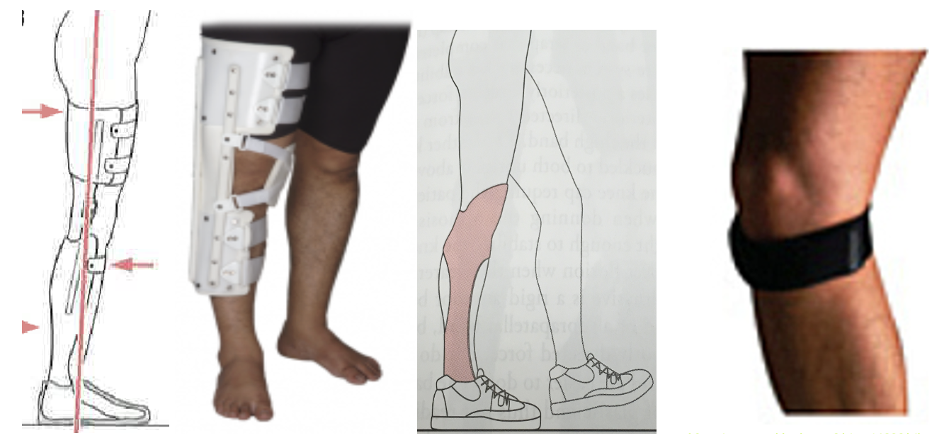 <p><span>A patient demonstrates knee instability during stance phase, specifically excessive knee flexion (knee buckling) due to quadriceps weakness, but has adequate ankle range of motion and no significant mediolateral knee instability. Which orthosis is generally the </span><strong>BEST </strong><span>choice?</span></p>