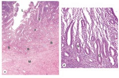<p>What cellular processes occur in the proliferative phase?</p>