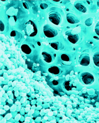 <p>Calcium carbonate crystals.</p>