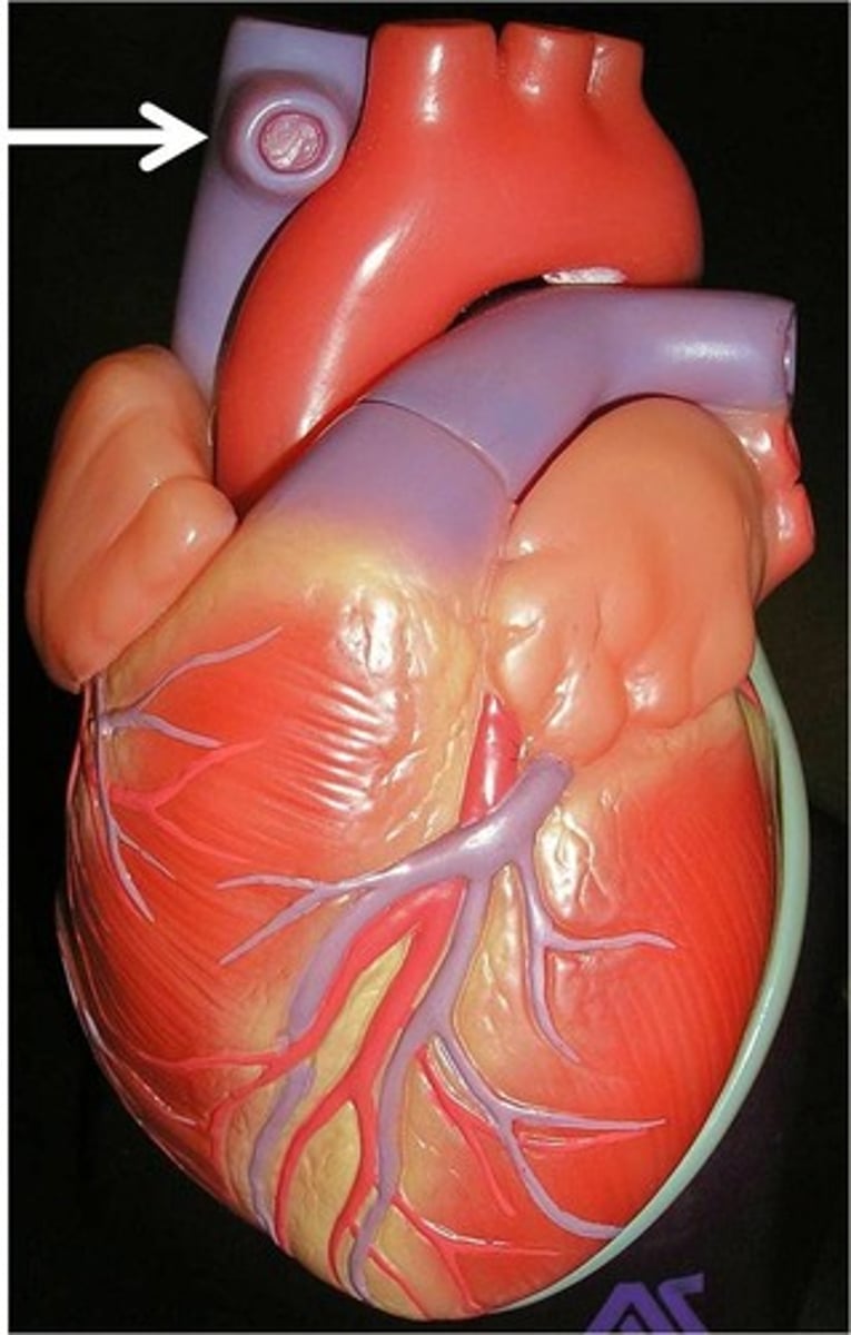 <p>large vein that returns deoxygenated blood to the heart from the upper body</p>
