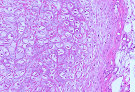 <p>elastic cartilage</p>