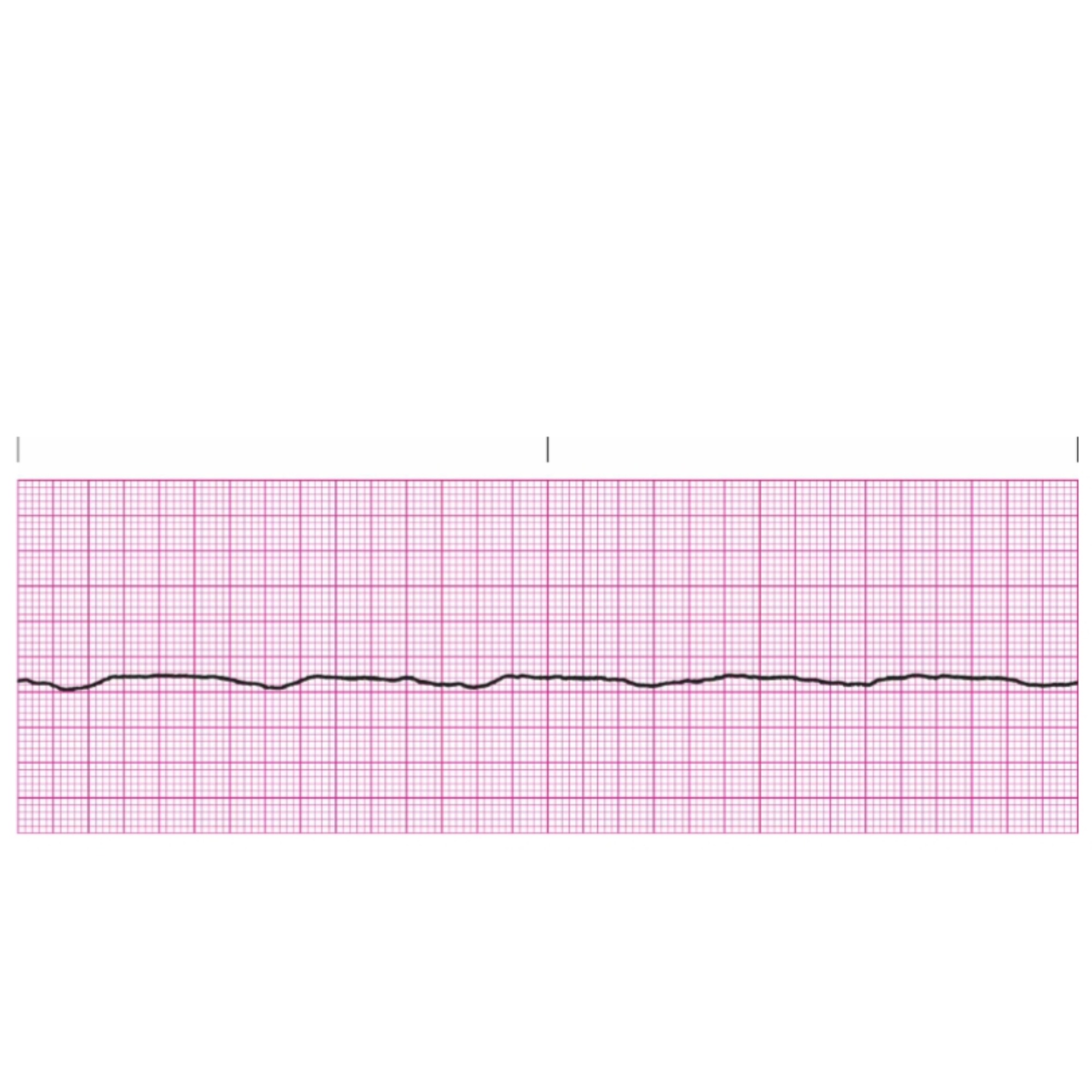 <p>Rules for Asystole includes</p>