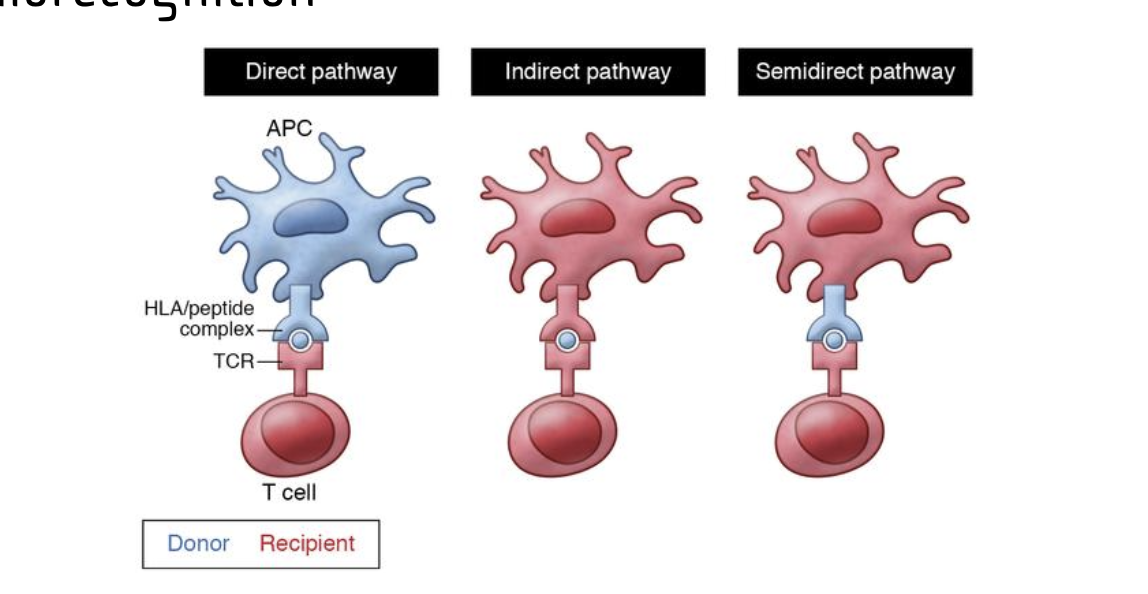 <p>Direct pathay</p><ul><li><p>Donor APcs connect and prosent dornor antigens to host t cell</p><ul><li><p>uses hla/peptide complex</p></li><li><p>results in activation of large polyclonal T cell response</p></li><li><p>responsible for <strong>acute rejection</strong></p></li></ul></li><li><p>indirect =</p><ul><li><p>recipient apc presents donor antigen using its own presention receptor to recipent t cell</p></li><li><p>Recipient apcs present donor antiges (both MHC and minor self antigens) on self to t cells = responsible for <strong>chronic graft rejection</strong></p></li></ul></li><li><p>semidrect pathway</p><ul><li><p>recipent apc obtains donor MHCs from plasma membrane trasfer</p></li><li><p><span>Semi-direct allorecognition relates to acute rejection</span> because <mark>recipient antigen-presenting cells (APCs) acquire and display intact donor MHC molecules, activating T cells that damage the graft</mark>.</p></li><li><p>they present forgien MHC: antigen to T cells = assive polyclonal response</p><ul><li><p>robust, rapid, polyclonal response</p></li></ul></li><li><p>responsible for <strong>acute rejection</strong></p></li></ul></li></ul><p></p>