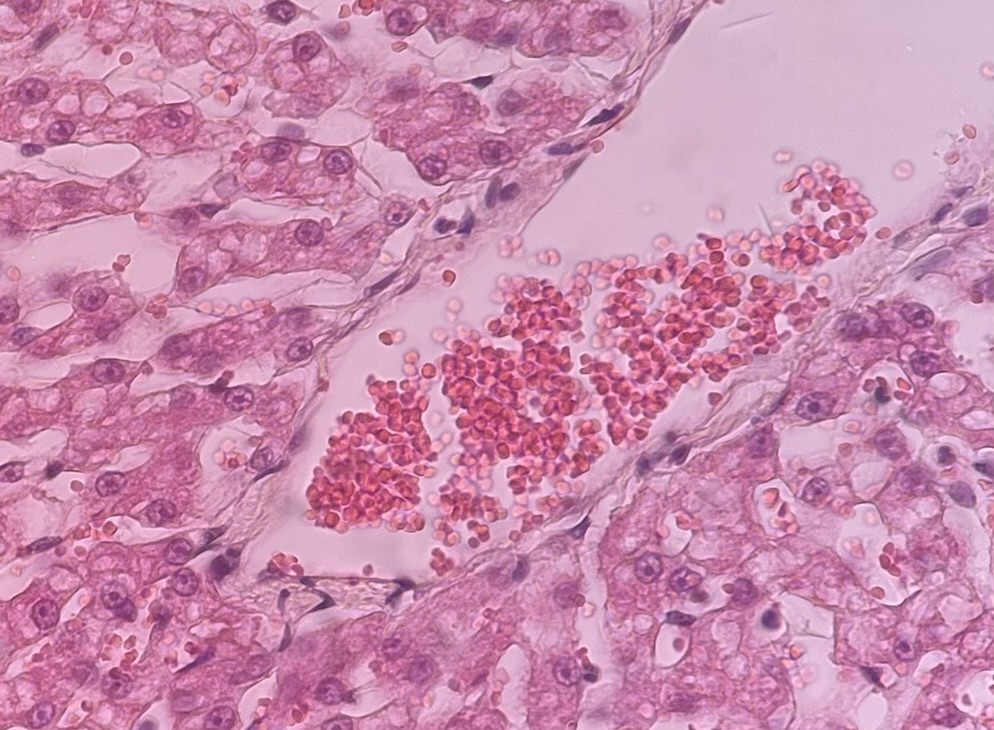 <p>The cells stained brightest pink/red here are _____ and are great indicators on how well a eosinophilic stain is uptaking in a sample.</p>