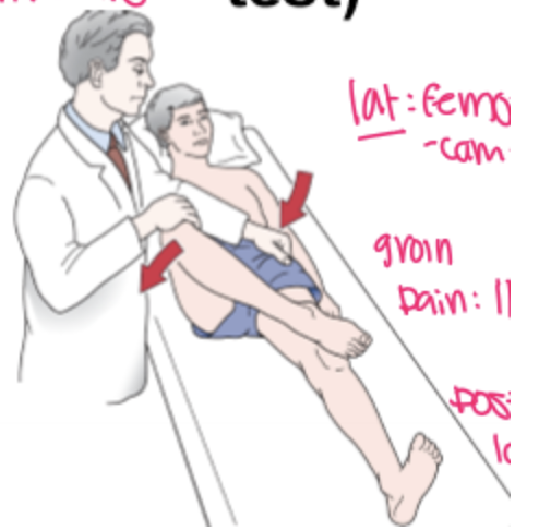 <ul><li><p><strong>How:</strong> Patient supine. Place the test leg in the <span style="background-color: transparent;"><em>&nbsp;</em><strong><em>Flexion, abduction, and external rotation (</em></strong></span><strong>FABER) position</strong> and lower the knee toward the table. <span style="background-color: transparent;">This position displaces the anterosuperior part of the femoral head-neck junction to the 12 o’clock position of the acetabular rim.</span></p></li><li><p><strong>Positive:</strong> <strong>Pain provocation</strong> and/or the <strong>test knee remains above the opposite leg (does not reach the table)</strong>. Pain location helps identify the source:</p><ul><li><p><strong>Lateral pain</strong> → <strong>Superolateral/lateral FAI</strong></p></li><li><p><strong>Groin pain</strong> → <strong>Iliopsoas pathology, psoas impingement, or anterior capsule involvement</strong></p></li><li><p><strong>Posterolateral pain</strong> → <strong>Ischiofemoral (ischiotrochanteric) impingement</strong></p></li><li><p><strong>Posterior pain</strong> → <strong>Sacroiliac joint involvement</strong></p></li></ul></li><li><p><span style="background-color: transparent;">(<strong>-) test </strong>if&nbsp; the test leg’s knee falling to the table or being parallel with the opposite leg.&nbsp;</span></p></li></ul><p></p>