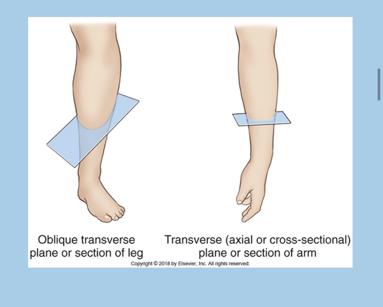 <p>divides a portion of the body into two parts going across the part</p>