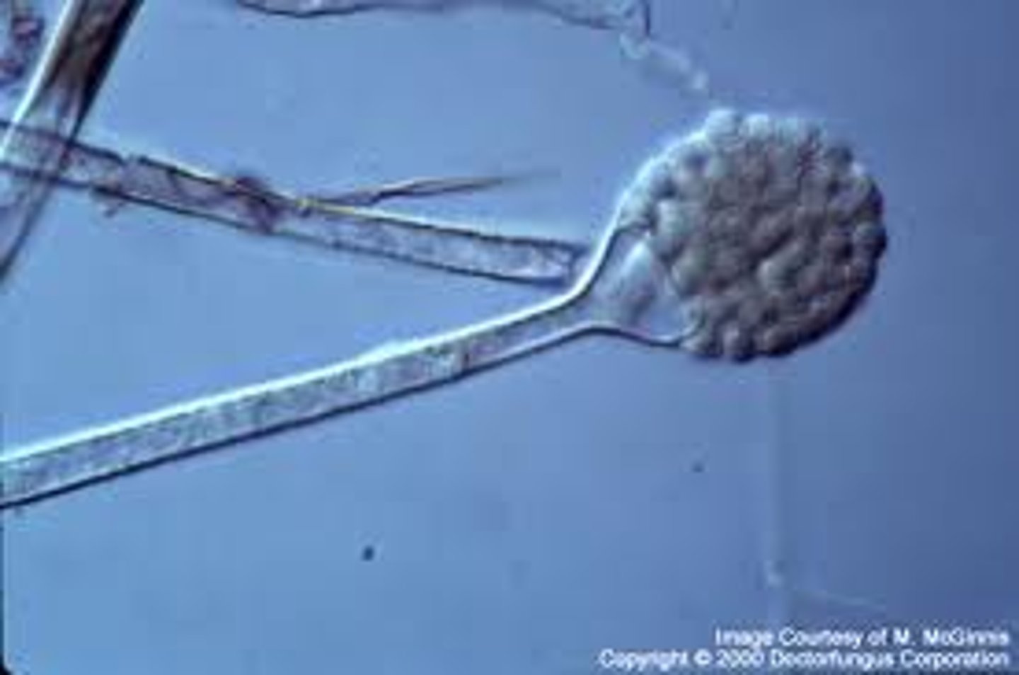 <p>Pear shaped sporangia</p>