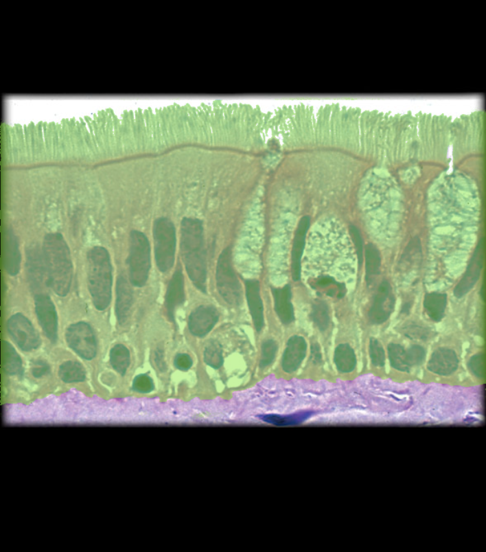 term image