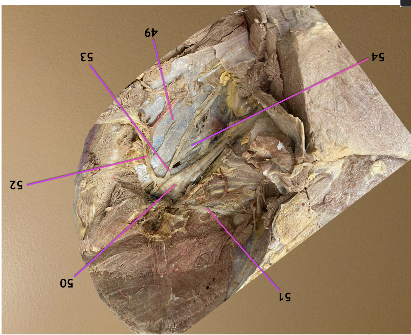 <p>lateral view, head to left, dorsal to top</p><p>.</p><p>label 49, 54</p>