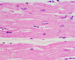 <p>-striated</p><p>-one nucleus</p><p>-located in heart</p>