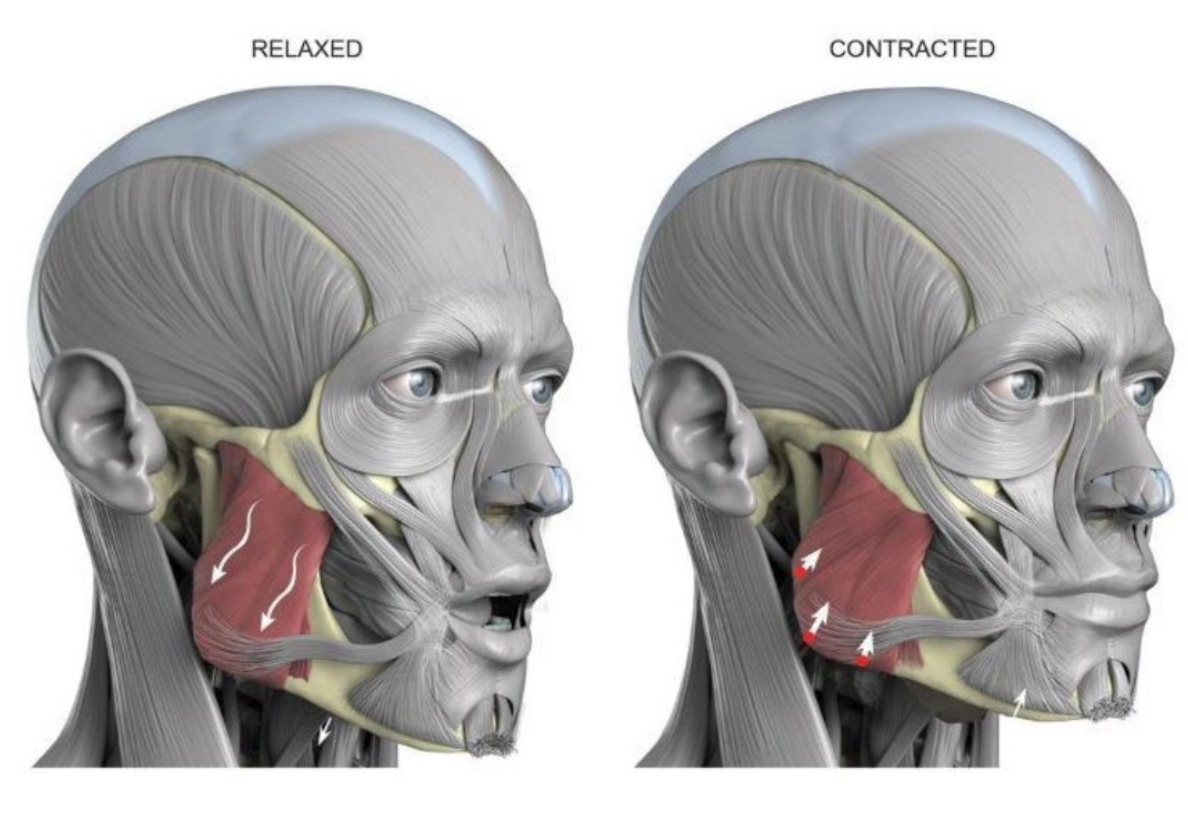 <ul><li><p>raises mandible</p></li><li><p>helps protrude mandible (superficial fibres)</p></li><li><p>helps retract mandible (deep fibres)</p></li></ul><p></p>