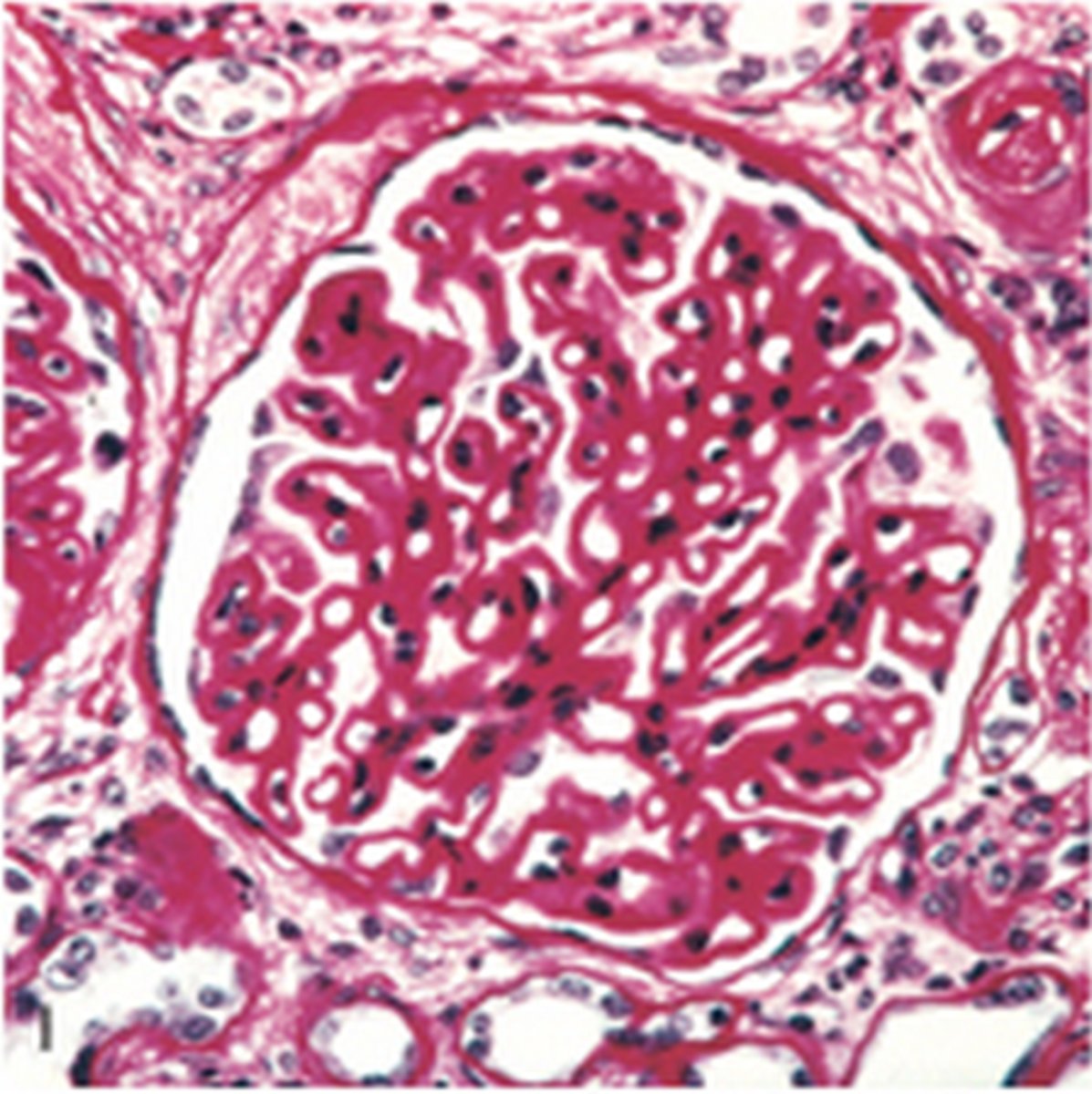 <p>general stain</p>