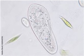 <p>This protozoa (ciliate) are slipper shaped and travel using cilia</p>