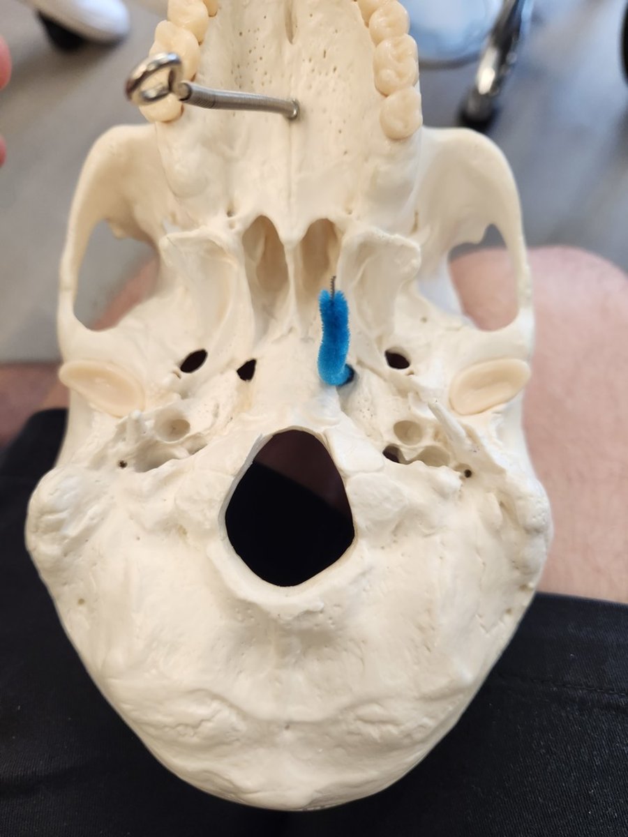 <p>What is this opening?</p><p>And what structure passes through this?</p>