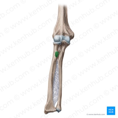 <p>Name the specific part of the bone in color</p>
