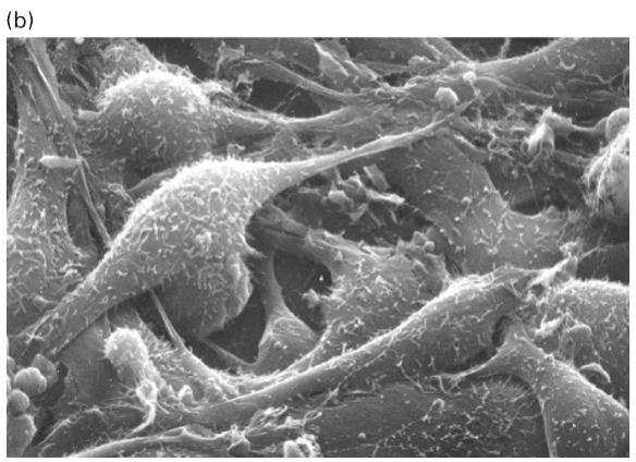 <p>is this a normal or transformed cell?</p>