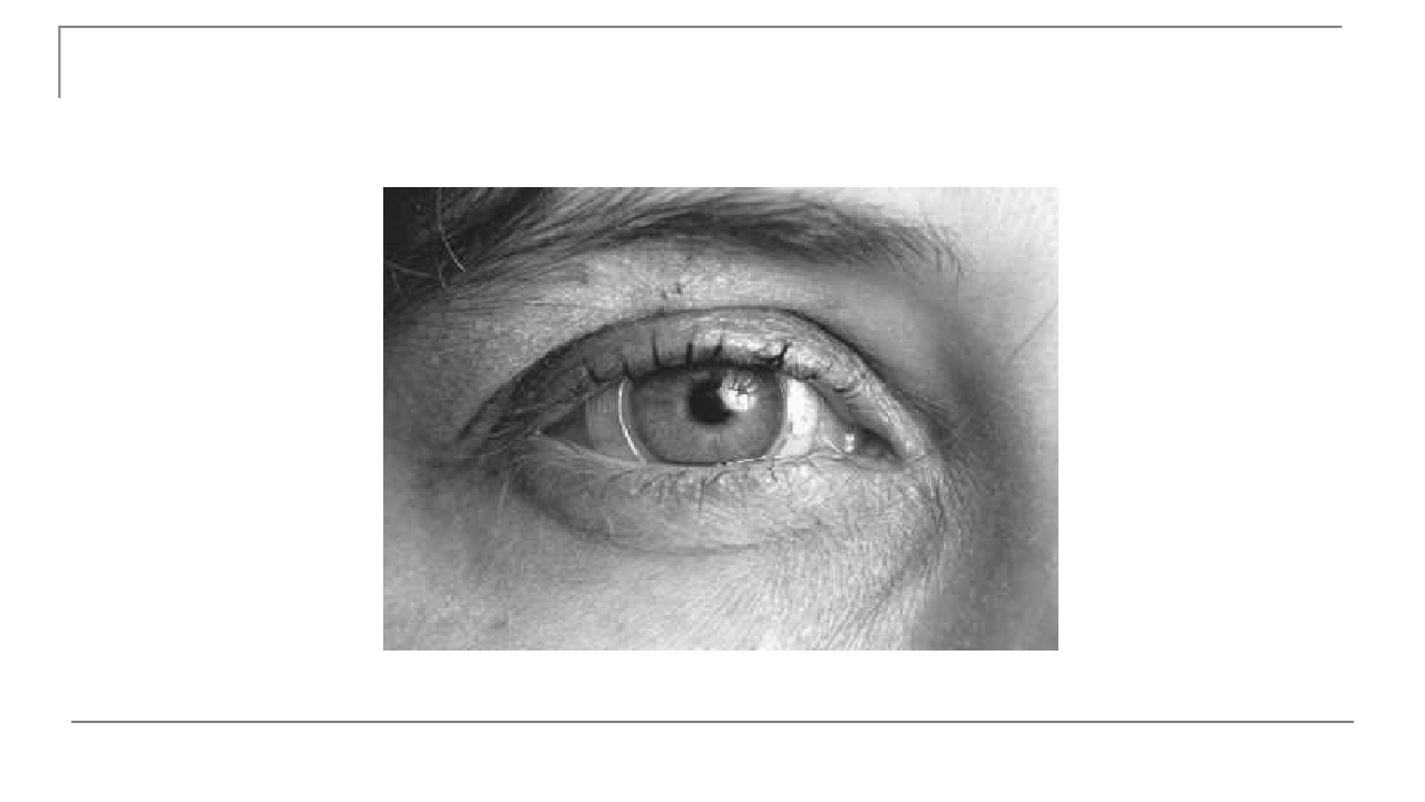 <ul><li><p>Subject placed in a magnetic field</p></li><li><p>Wears a contact lens (silicone annulus) with embedded wire coil</p></li><li><p>Eye movement → coil moves → voltage induced</p></li><li><p>Voltage ∝ sine of angle between coil plane and magnetic field</p></li><li><p>Signal reflects precise eye position</p></li></ul><p></p>