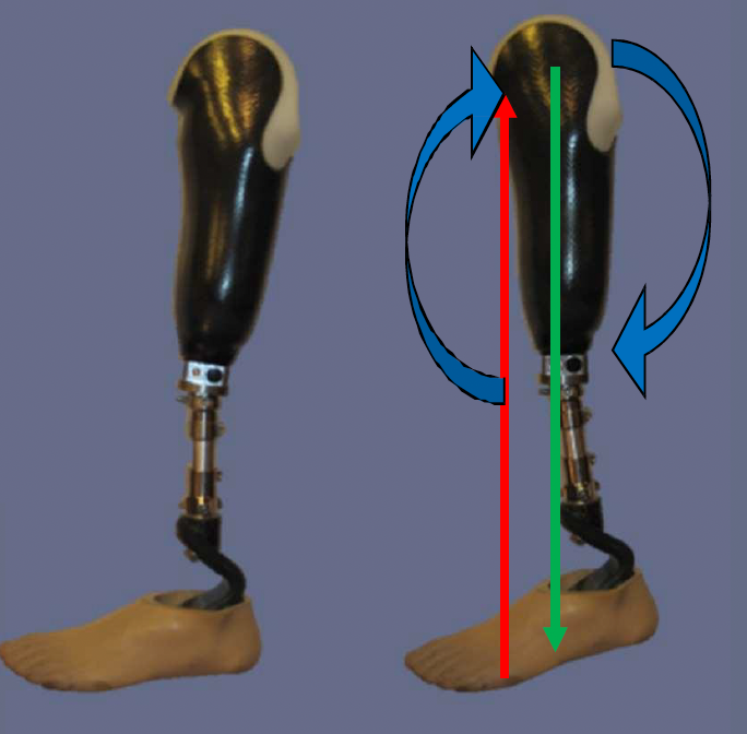 <p>anterior proximal, posterior distal</p>