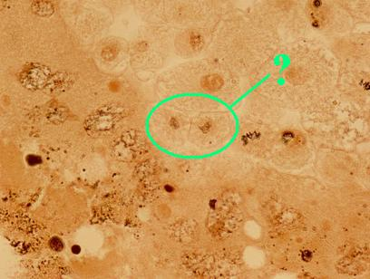 <p>Identify the indicated phase of mitosis</p>