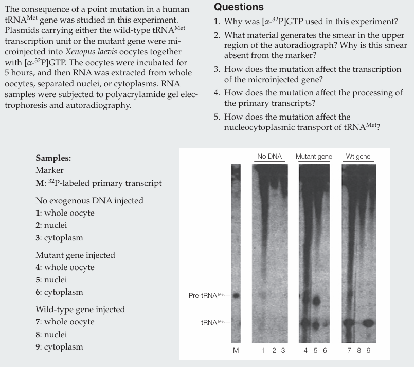 <p>What material generates the smear in the upper region of the autoradiograph? Why is this smear absent from the marker?</p>