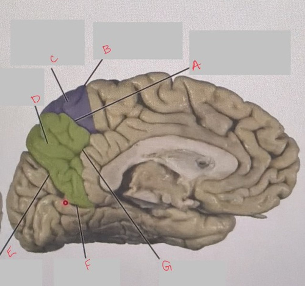 <p>What structure is labeled G?</p>