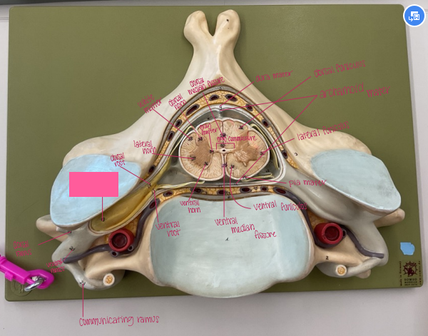 <p>What s being shown? </p>