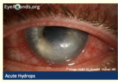 <p>describe and give diagnosis </p>