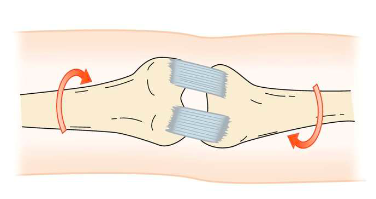 <p>Rotary/Torsion</p>