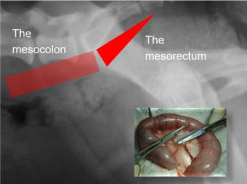 <ul><li><p>mesocolon</p></li><li><p>mesorectum </p></li></ul><p></p>