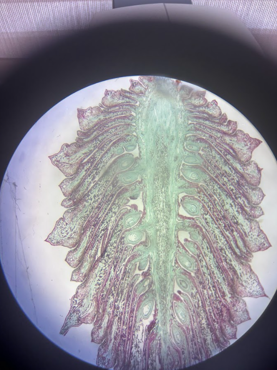 <ul><li><p><strong>Diploid</strong></p></li><li><p><strong>Sporophyte</strong></p></li></ul><p>Contains: </p><ul><li><p><strong>Megaspore</strong></p><ul><li><p><strong>Haploid (n)</strong></p></li><li><p>Produced by meiosis inside ovule</p></li></ul></li><li><p><strong>Megagametophyte</strong></p><ul><li><p><strong>Haploid (n)</strong></p></li><li><p>Produces <strong>egg</strong> (haploid)</p></li><li><p>Much larger than male gametophyte</p></li><li><p>Stays inside the ovule</p></li></ul></li><li><p><strong>Egg</strong></p><ul><li><p><strong>Haploid (n)</strong></p></li><li><p>Produced by megagametophyte</p></li><li><p>Fertilized by pollen‑delivered sperm nucleus</p></li></ul></li></ul><p></p>